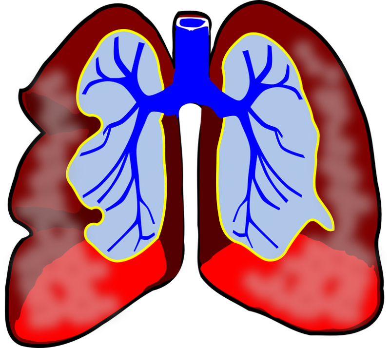 Détresse respiratoire : quelles sont les raisons ?